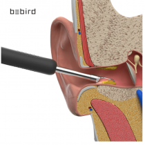 BEBIRD Otoscope Oreille, cuillères d'oreille WIFI sans Fil, avec